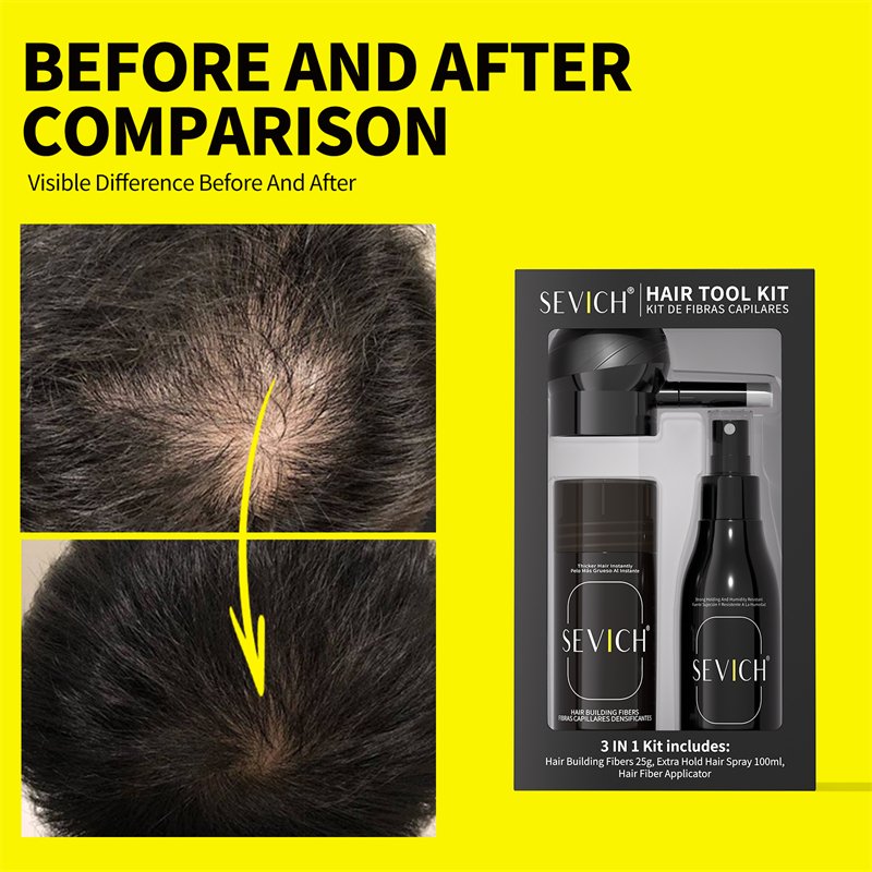 Sevich Hair Fiber Powder