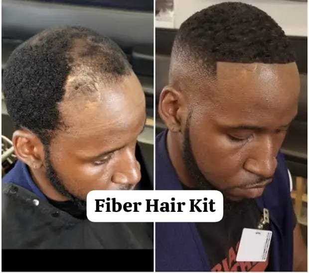 Sevich Hair Fiber Kit